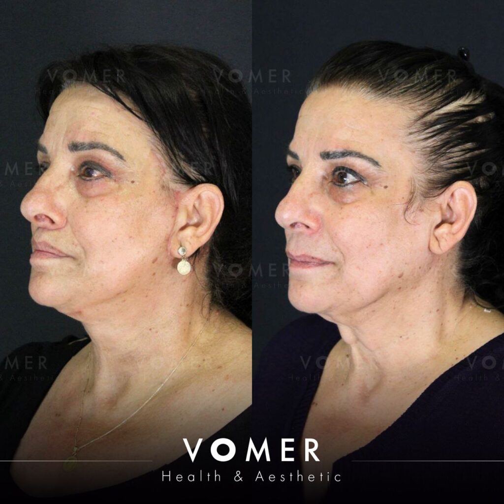 d8038f3e 93f1 495e 8da4 795febf40a24