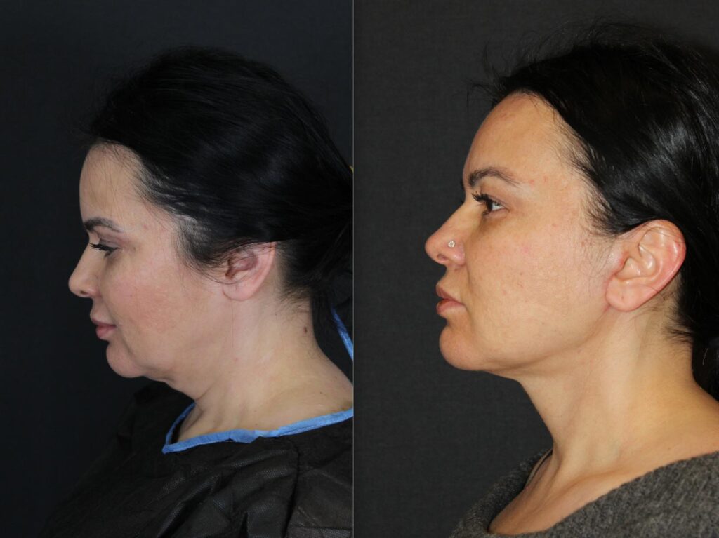 eed95c5a 38d7 4441 ac27 a93460858d12