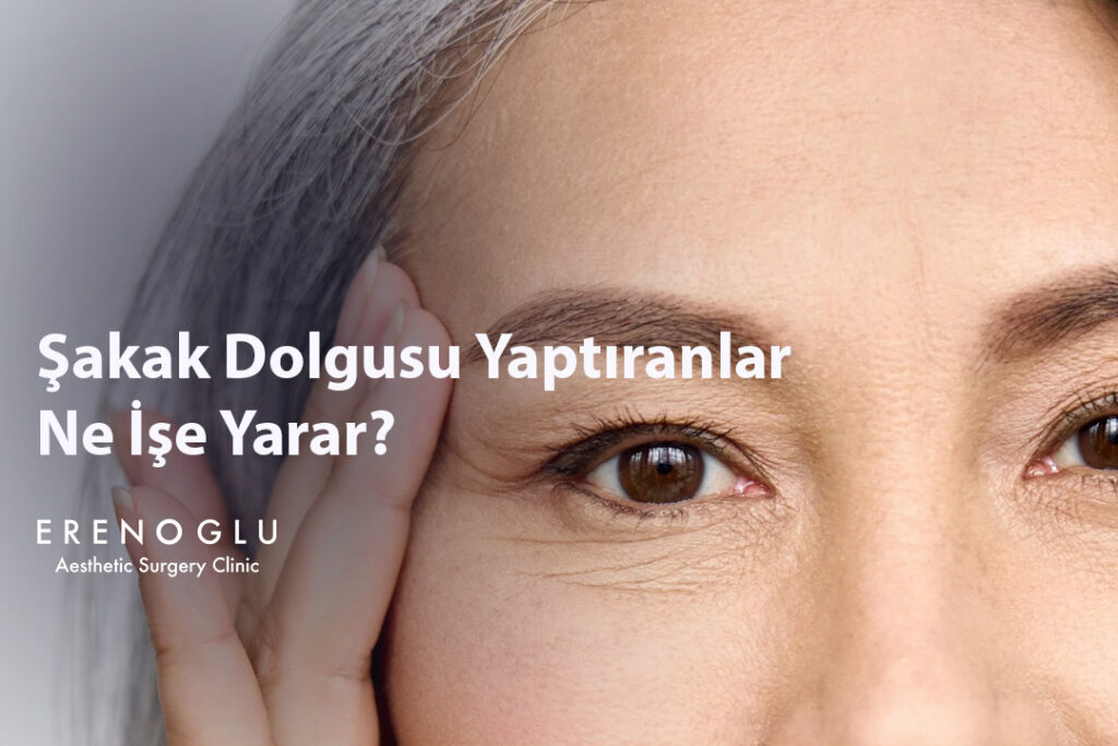 Şakak Dolgusu Yaptıranlar Ne İşe Yarar
