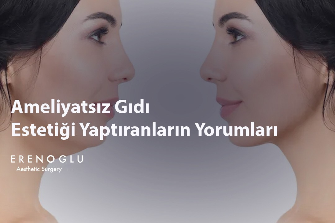 Ameliyatsız Gıdı Estetiği Yaptıranların Yorumları
