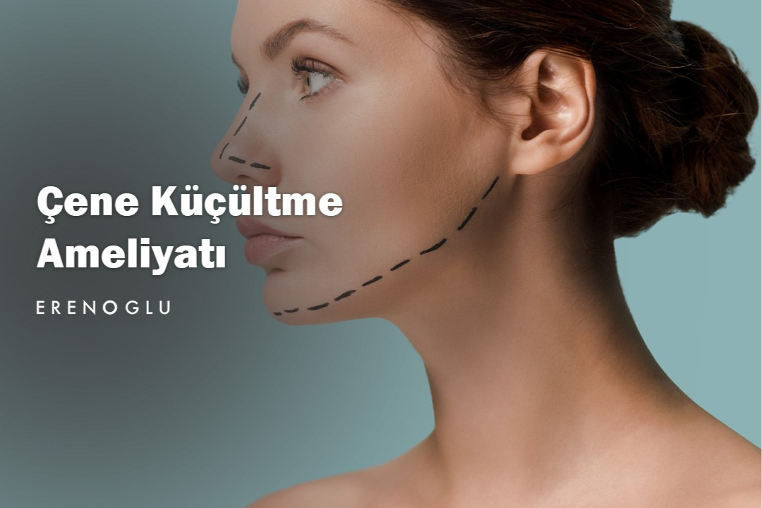 cene kucultme ameliyati