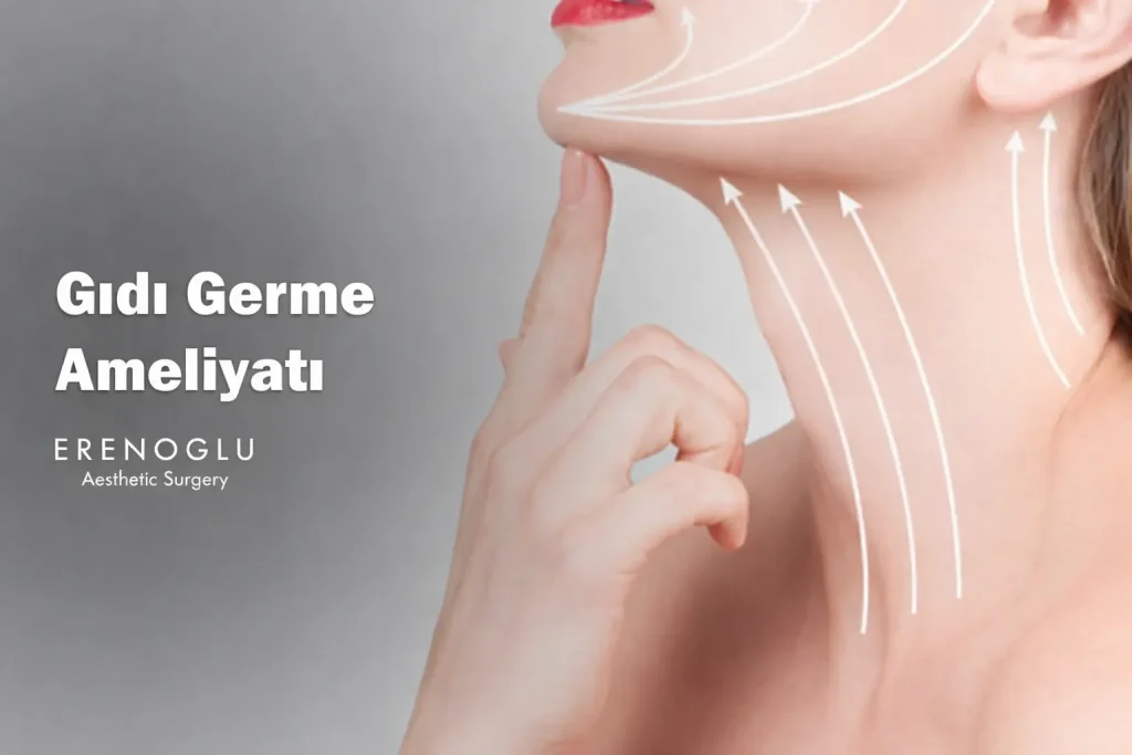 gıdı germe ameliyatı