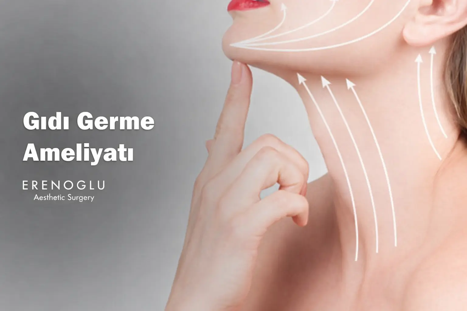 gıdı germe ameliyatı