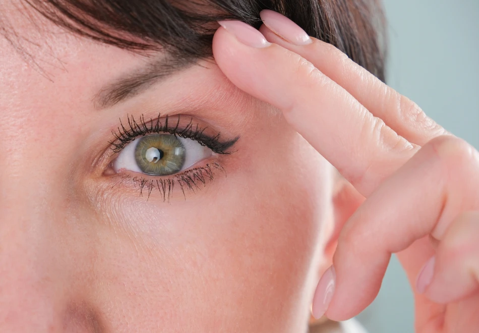 üst göz kapağı estetiği