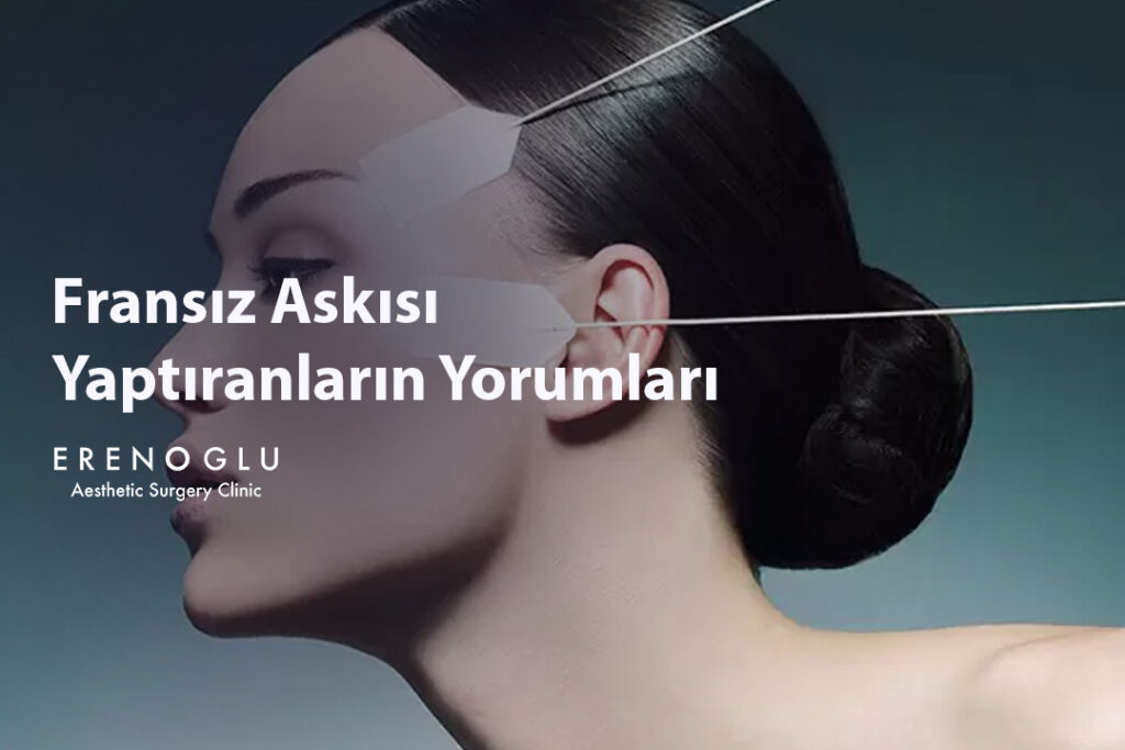 Fransız Askısı Yaptıranların Yorumları