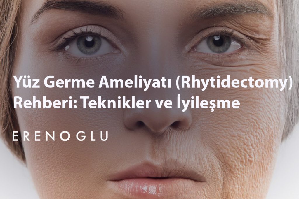 Yüz Germe Ameliyatı (Rhytidectomy) Rehberi Teknikler ve İyileşme